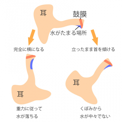 耳に水が入った時の対処